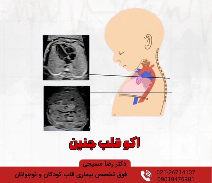 اکو قلب جنین اوسط دکتر رضا مسیحی