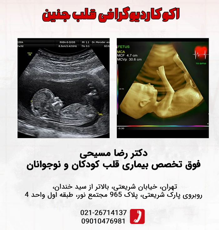 اکوکاردیوگرافی قلب جنین