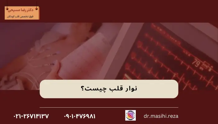 نوار قلب چیست؟ 