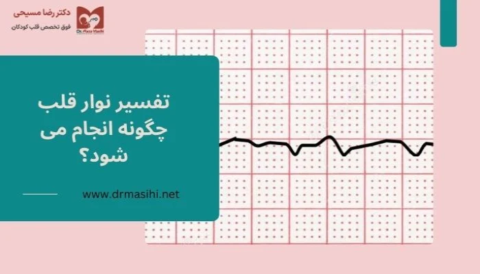 تفسیر نوار قلب چگونه انجام می شود؟