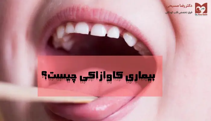 بیماری کاوازاکی چیست؟ 