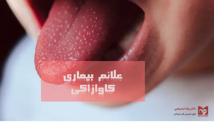 علائم  بیماری کاوازاکی 