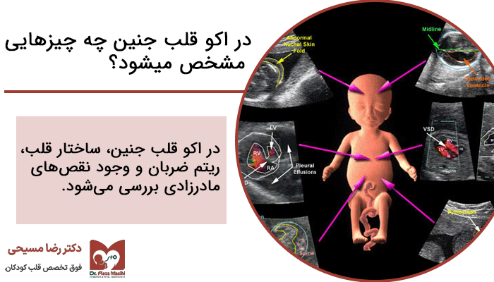در اکو قلب جنین چه چیزهایی مشخص می شود