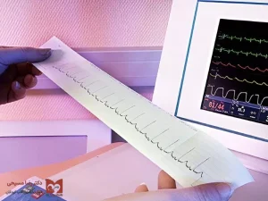 نوار قلب نرمال جنین