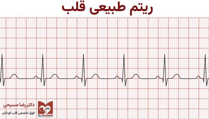 ریتم طبیعی قلب جنین