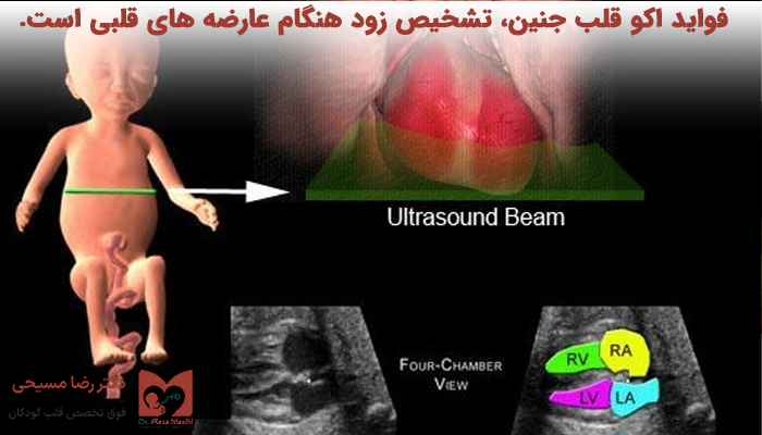 مزایا اکو قلب جنین