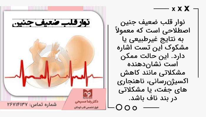 نوار قلب ضعیف جنین