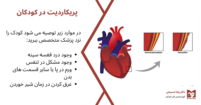 بیماری پریکاردیت در کودکان
