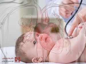 پریکاردیت در کودکان چیست