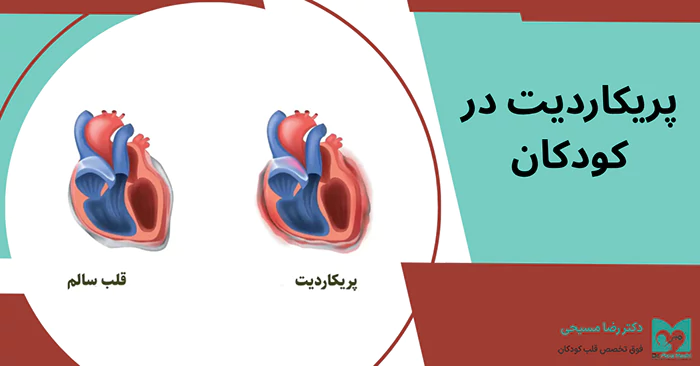 پریکاردیت در کودکان